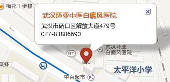 武汉环亚中医白癜风医院地图